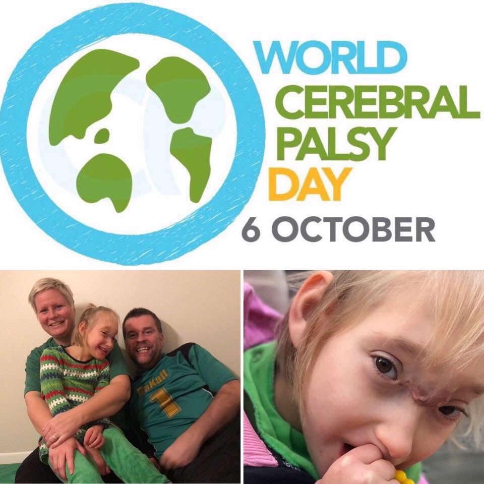 Image-3 World Cerebral Palsy Day