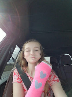 Fractured Hand!