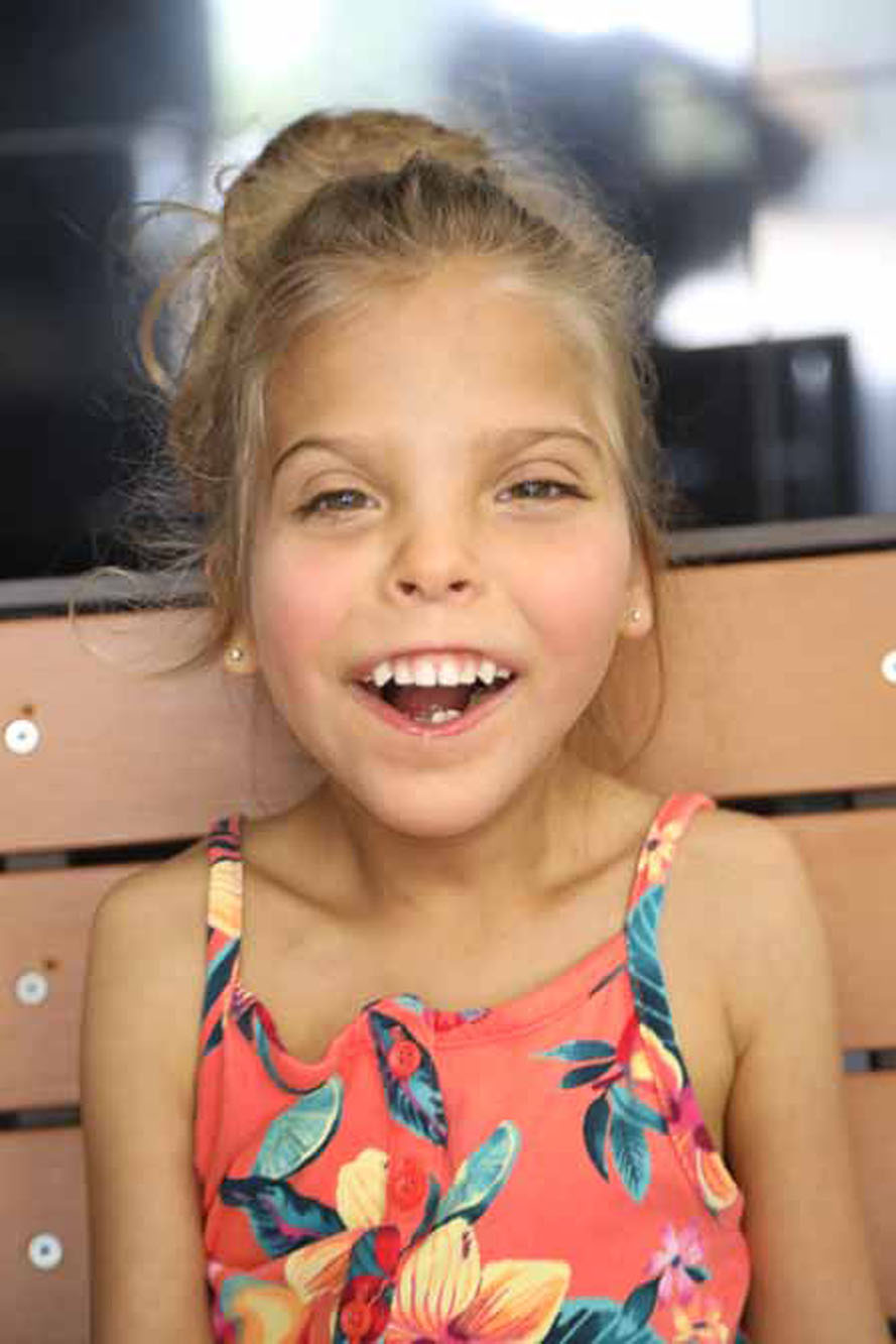 Smith Lemli Opitz 14