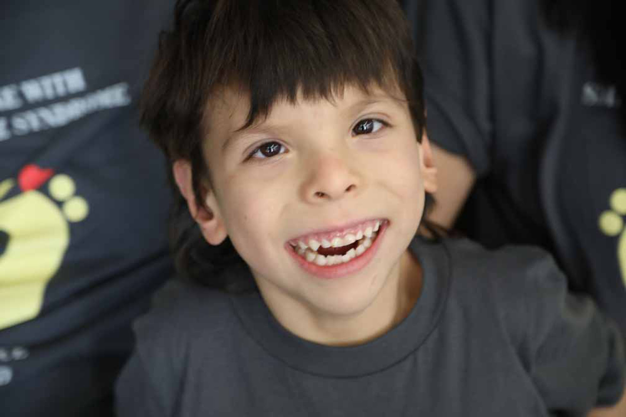 Smith Lemli Opitz 15