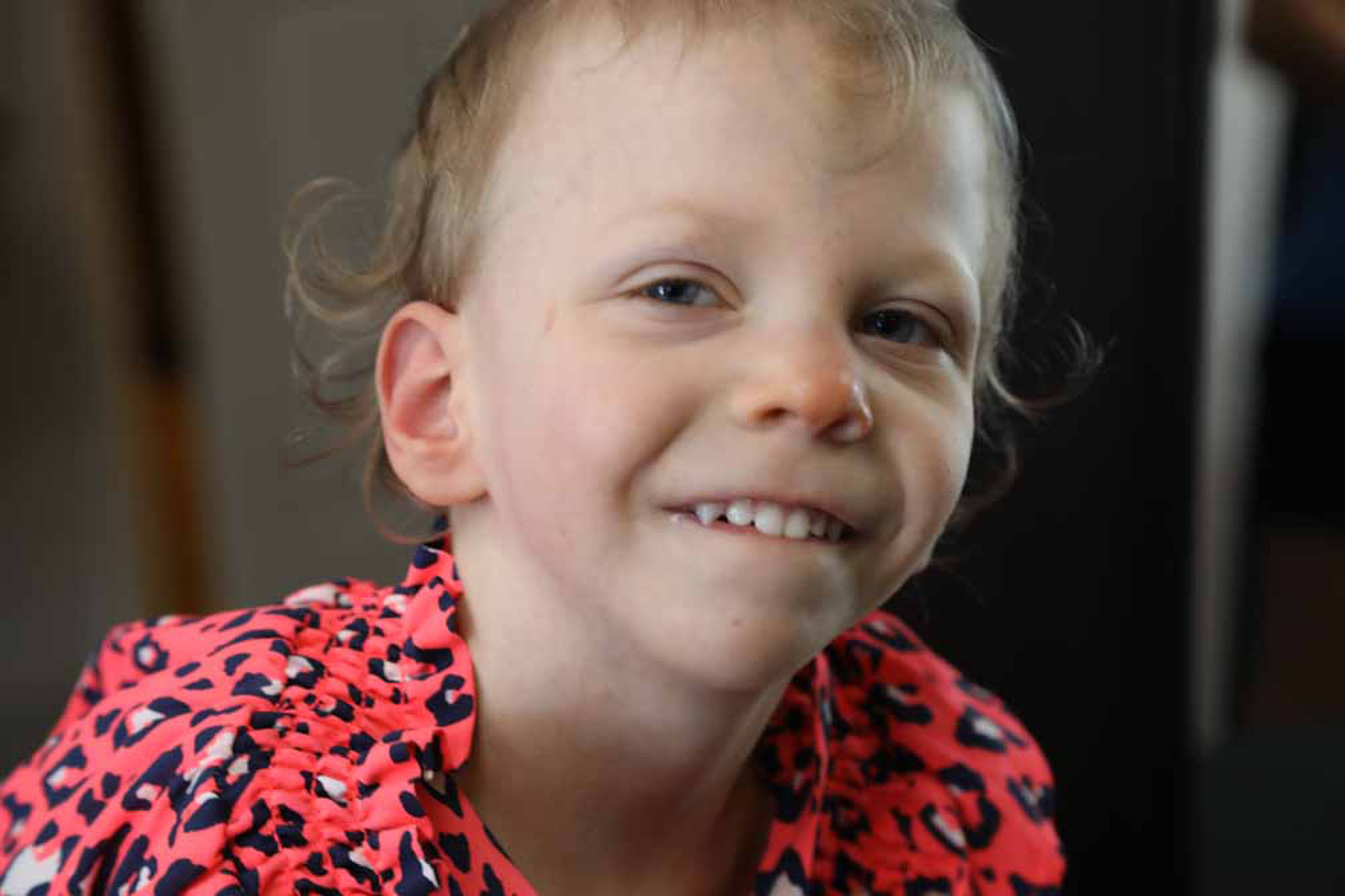 Smith Lemli Opitz 18