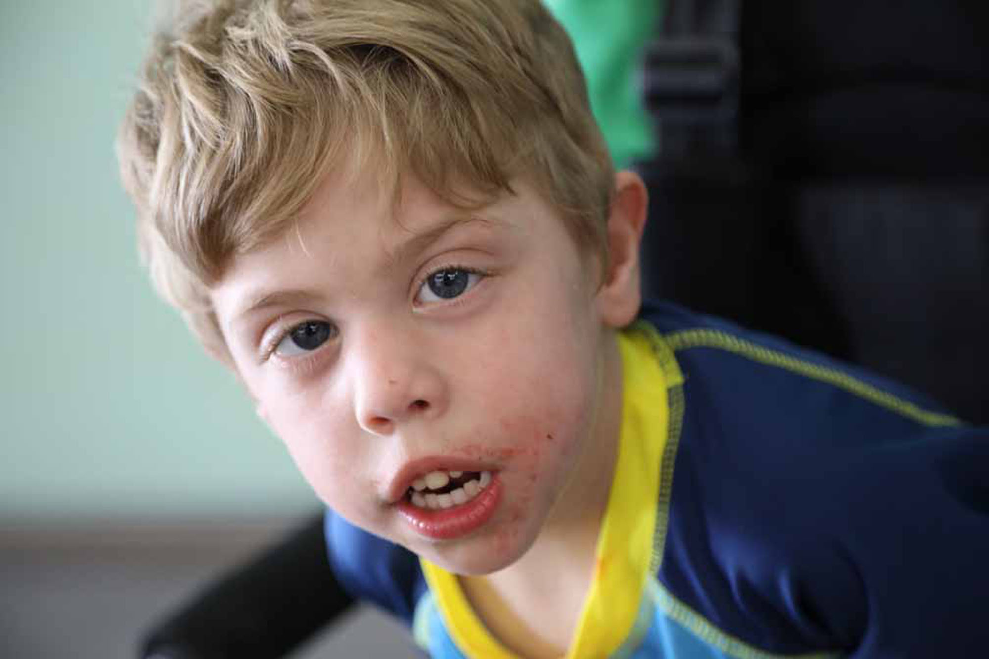 Smith Lemli Opitz 23