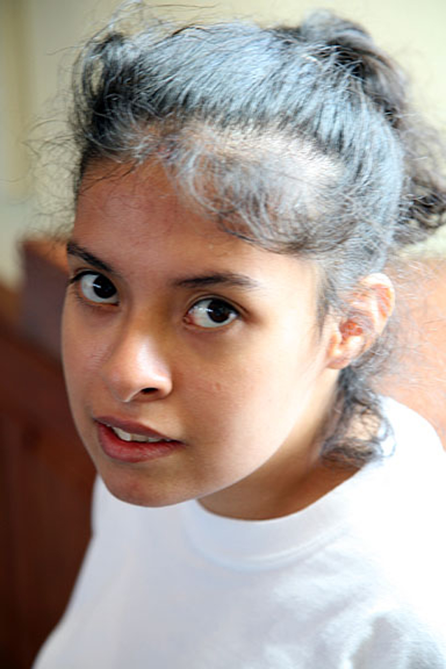 Prader-Willi Syndrome (18)