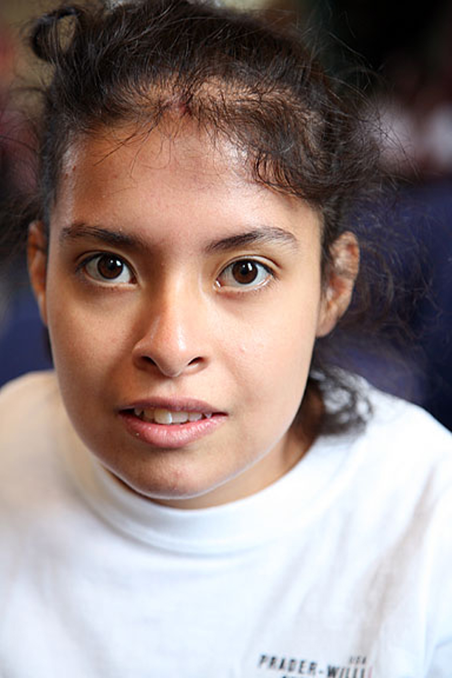 Prader-Willi Syndrome (16)