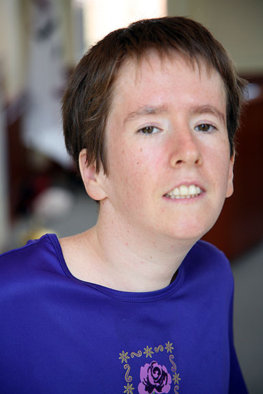 Prader-Willi Syndrome (10)