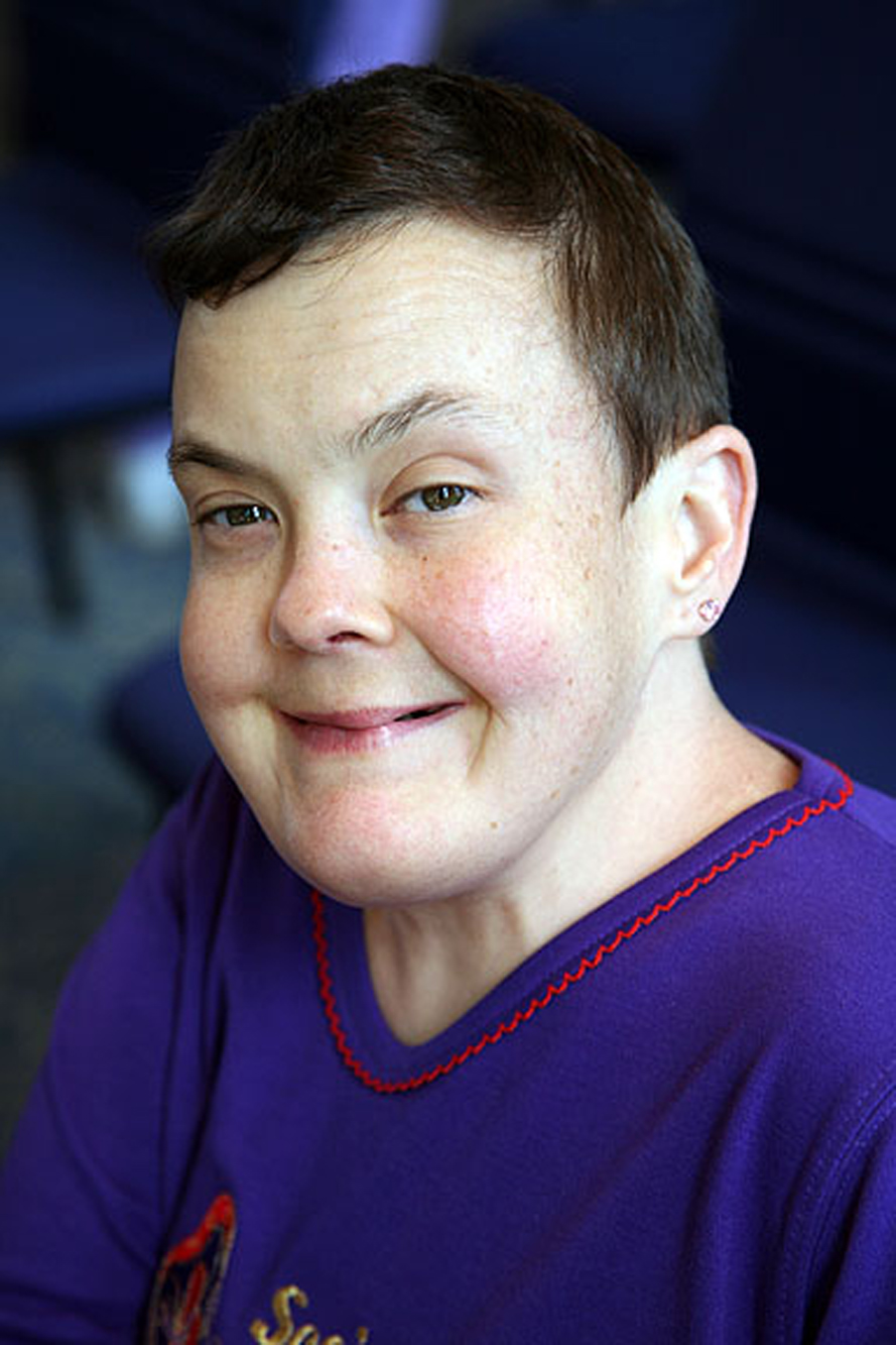 Prader-Willi Syndrome (7)