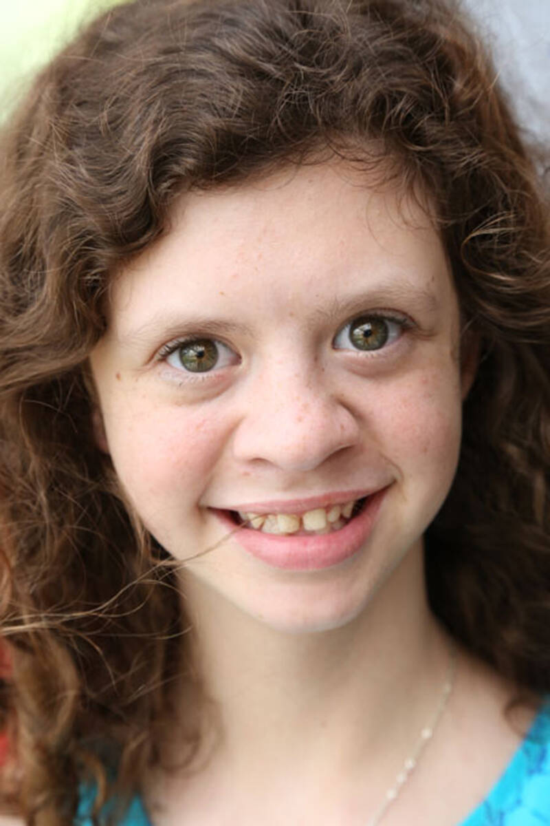 Williams Syndrome - Positive Exposure
