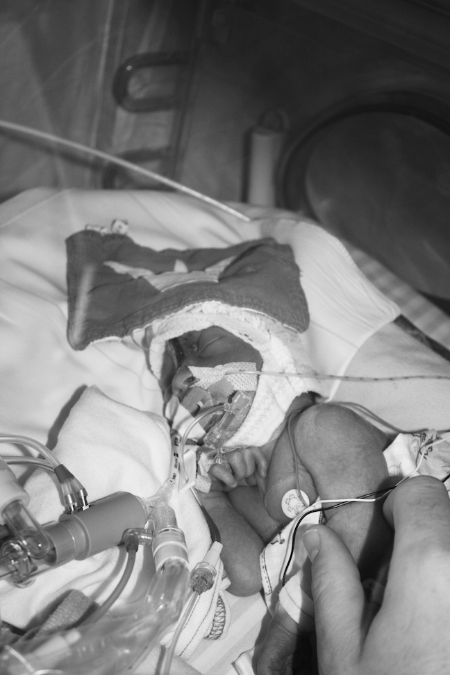 11.18.22 Today is World Prematurity Day