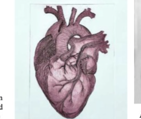 Line drawing of Aorta in muted reddish tones.