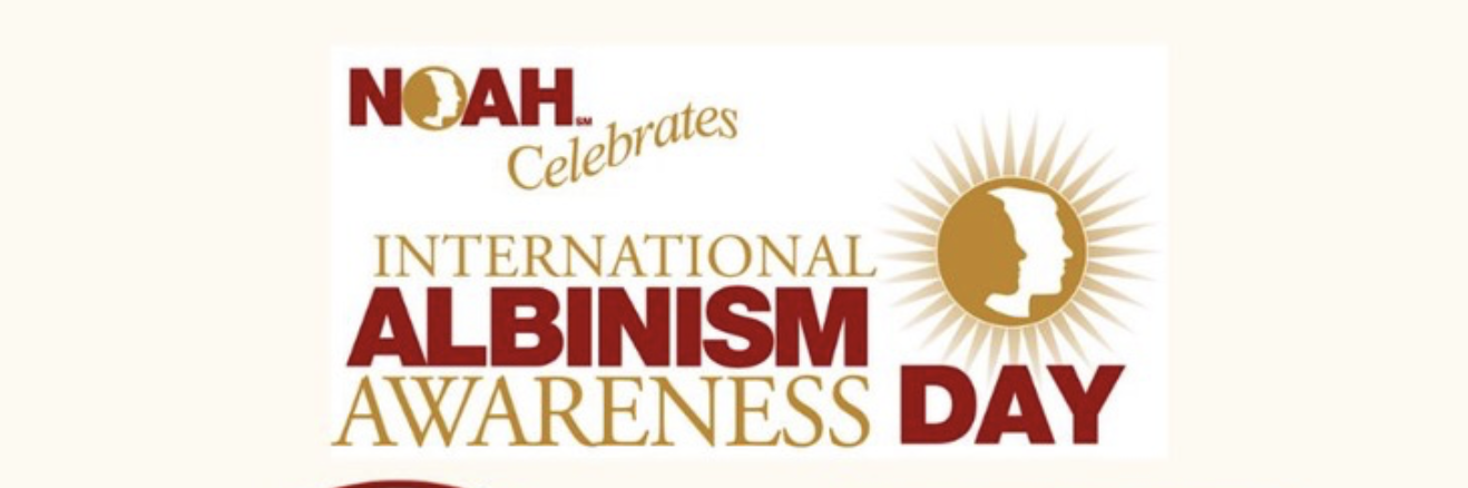 NOAH Celebrates Albinism International Awareness Day