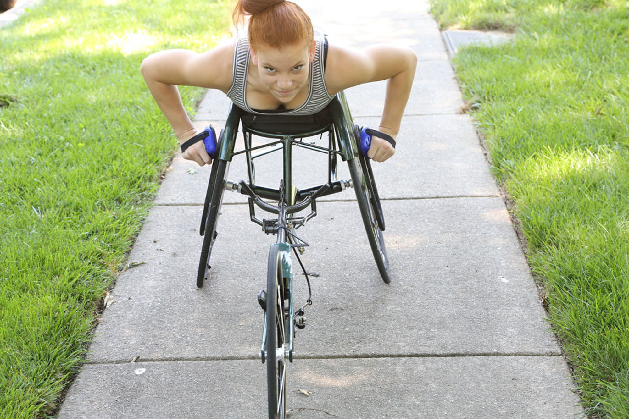 Woman with Sacral agenesis caudal regression on wheelchair