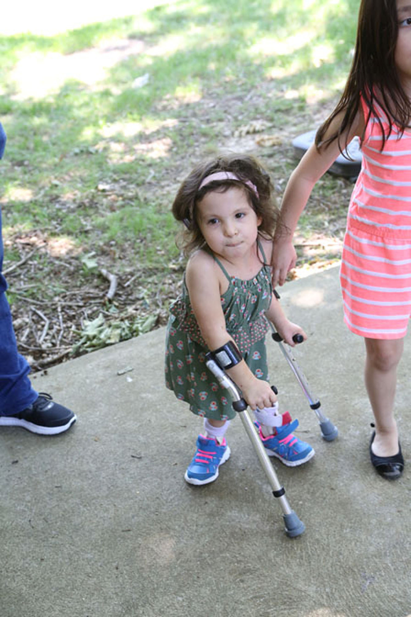 YOung girl with Sacral Agenesis caudal regression looks up at camera
