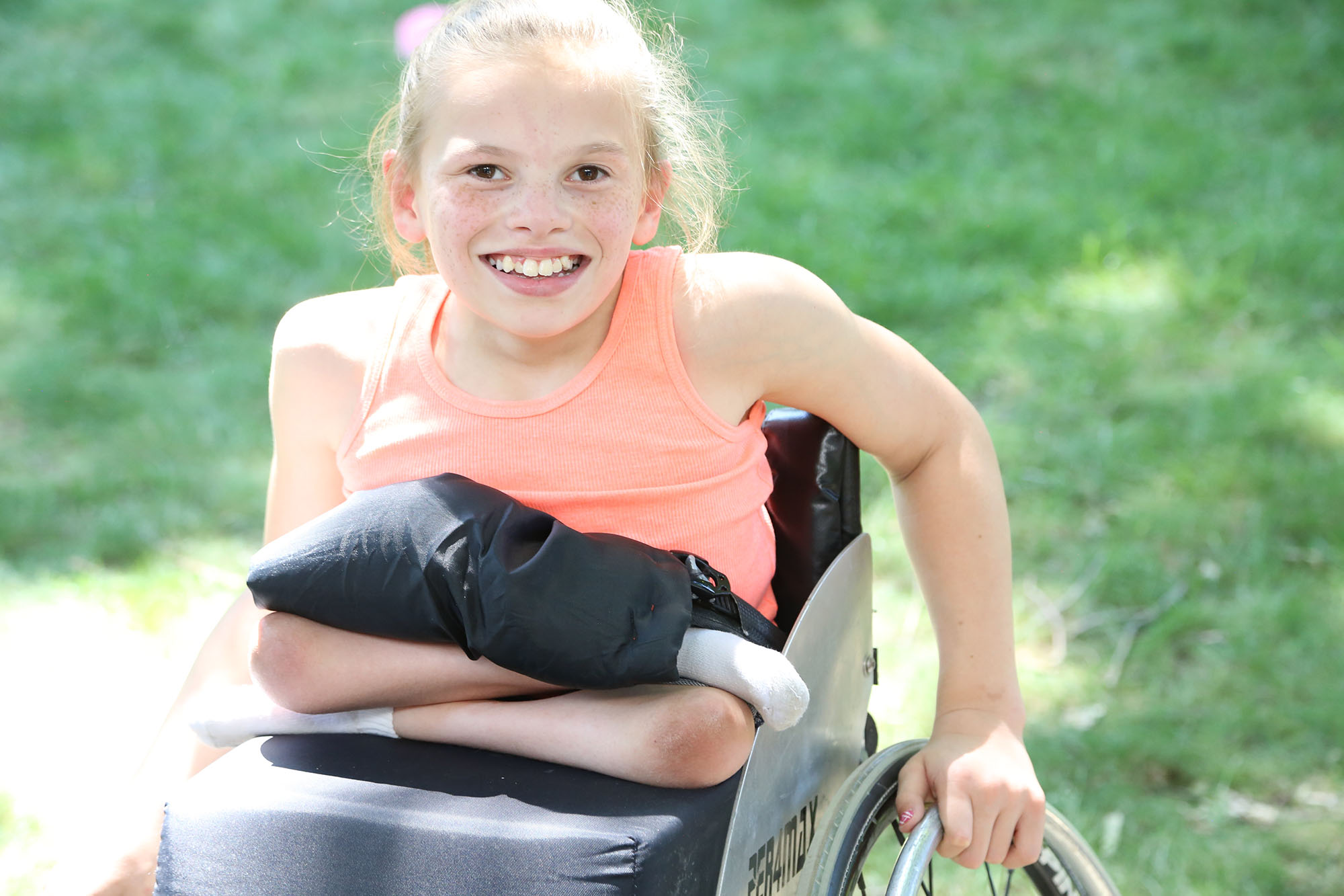 Girl with sacral agenesis Caudal regression sitting in wheelchair smiling