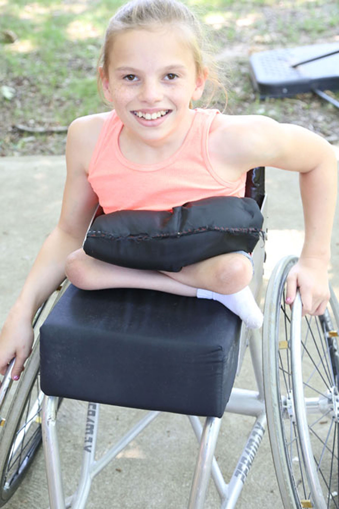 Girl with Sacral Agenesis Caudal regression in a wheelchair smiling at camera