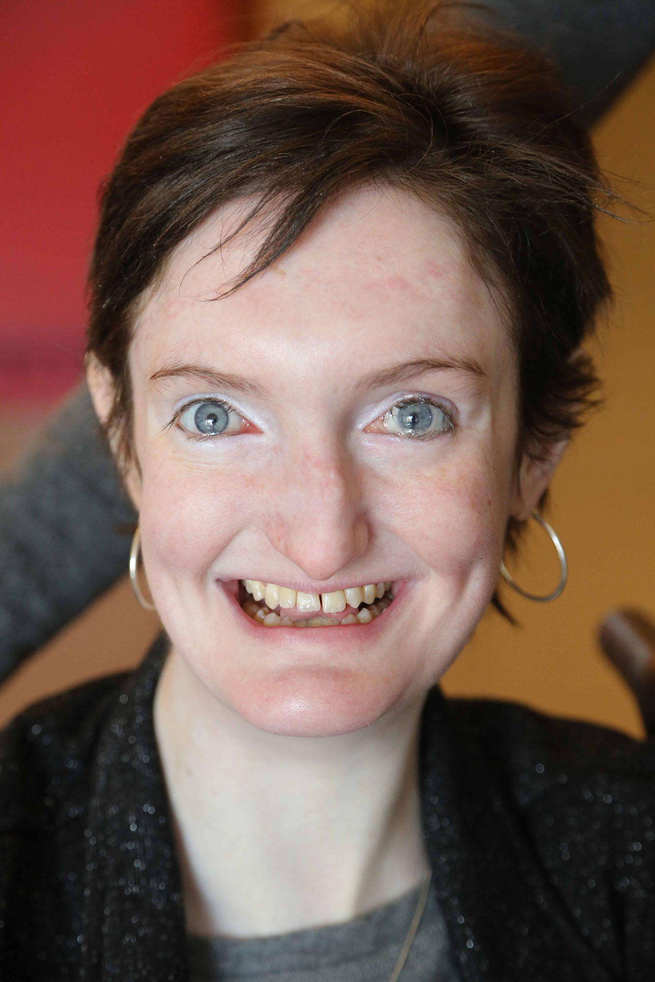 Woman with Familial Dysautonomia looking at the camera, smiling.