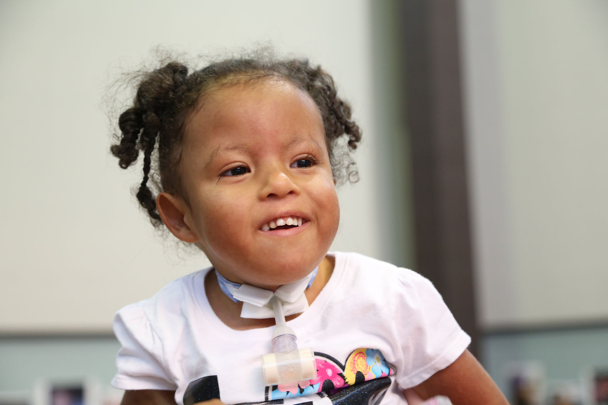 Young girl with Chromosome 18 Trisomy wearing pink smiles in candid photo