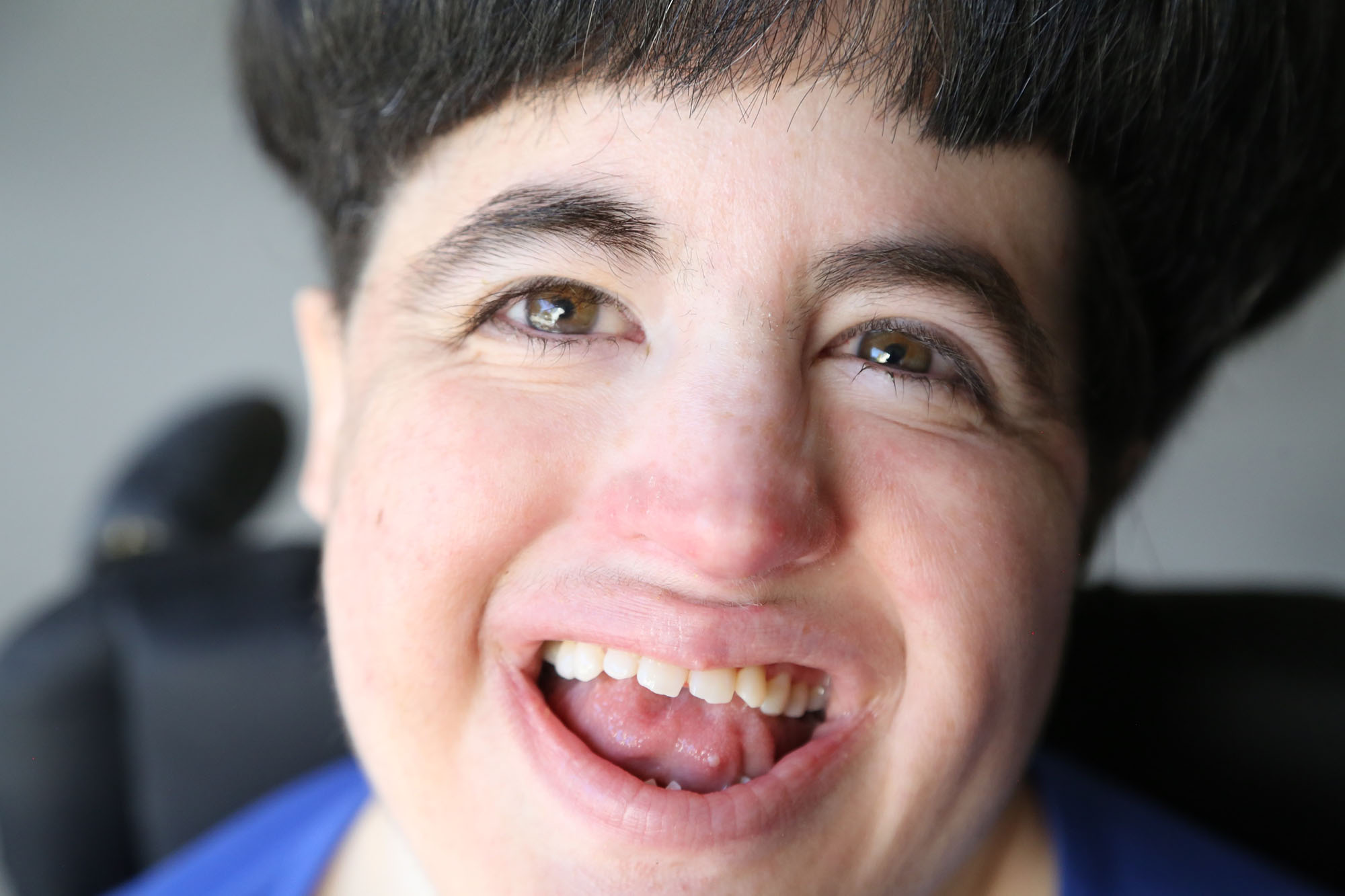 Woman with Chromosome 18 Trisomy smiles at camera in close up photo