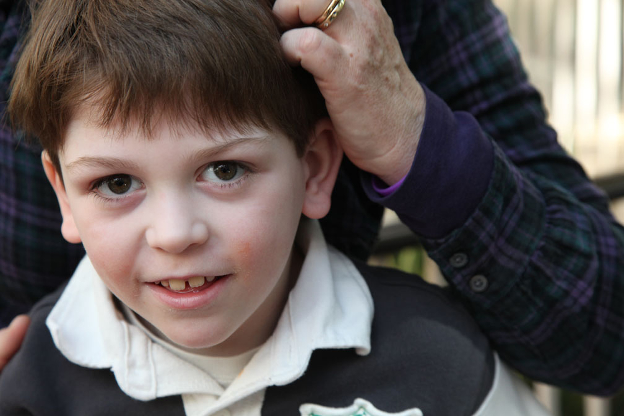 young boy with Dravet syndrome looks at camera while adult arm is resting on his head.