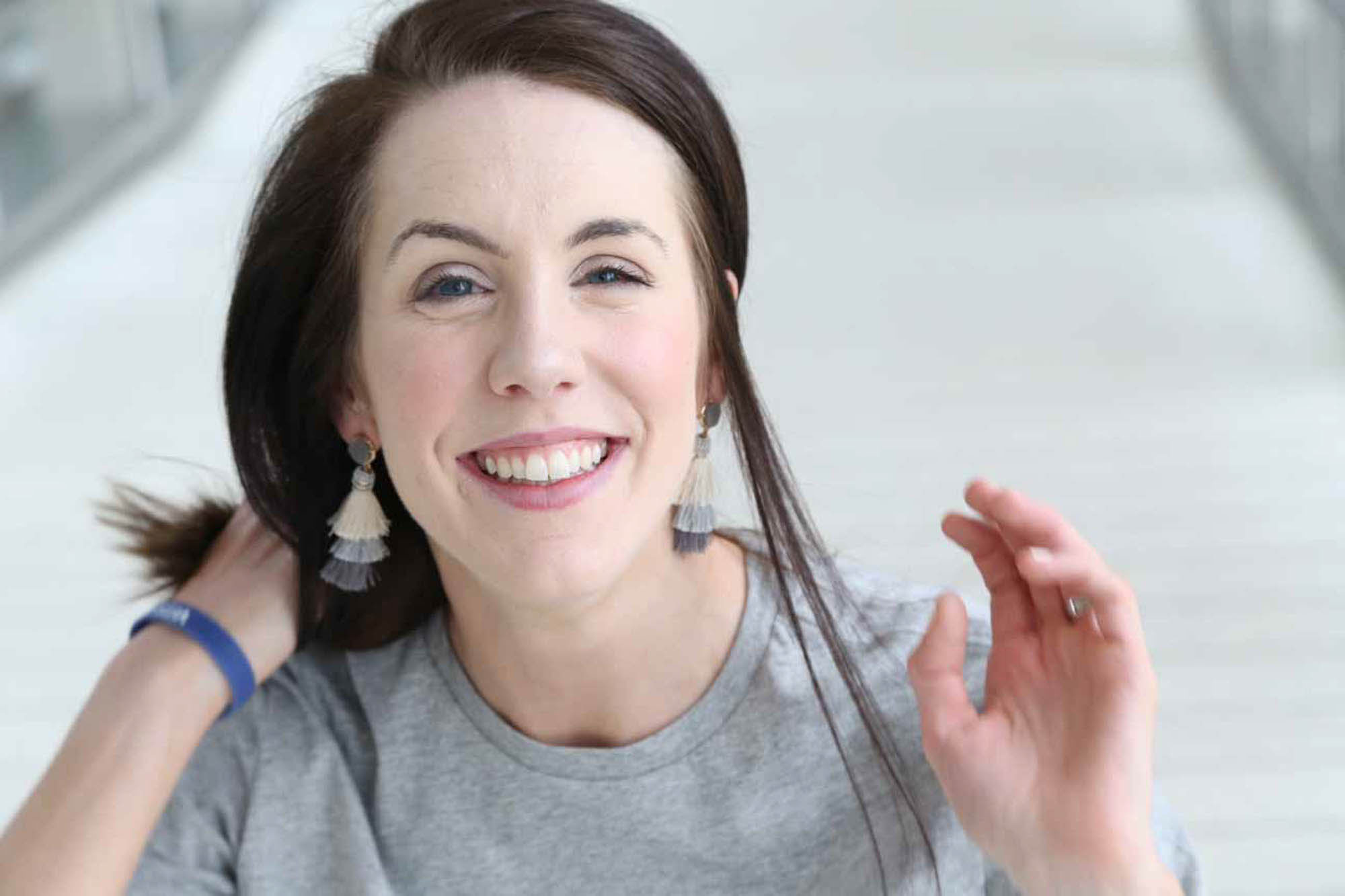 woman with Vitiligo smiling at the camera