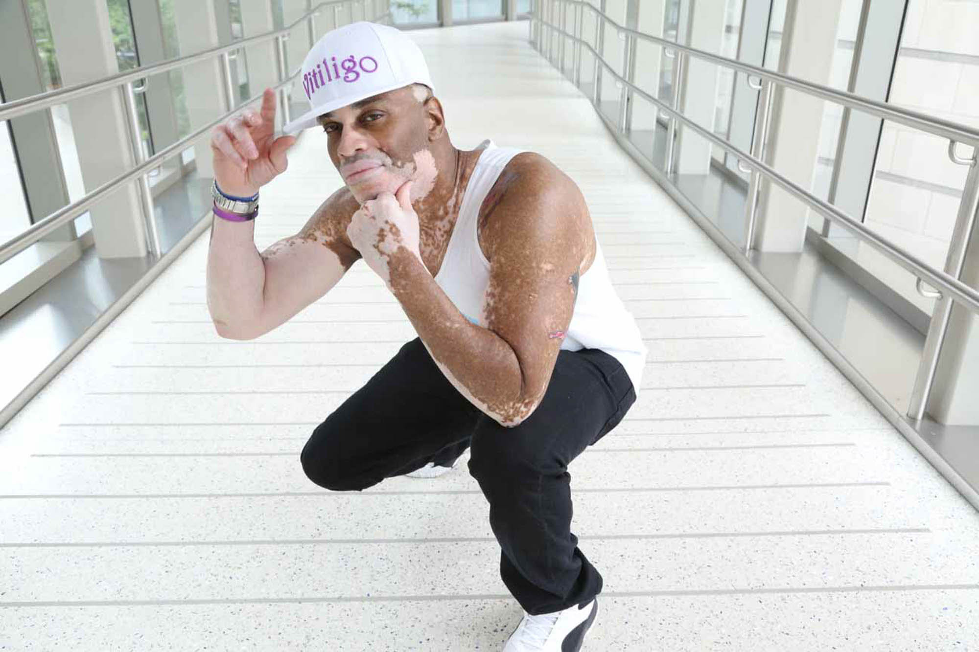 man with Vitiligo wearing a baseball cap crouching down