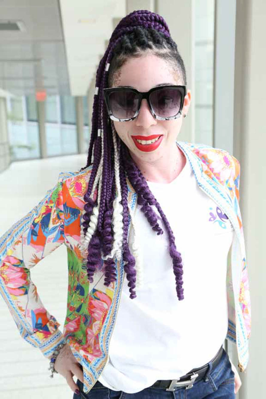 woman with Vitiligo wearing sunglasses and smiling