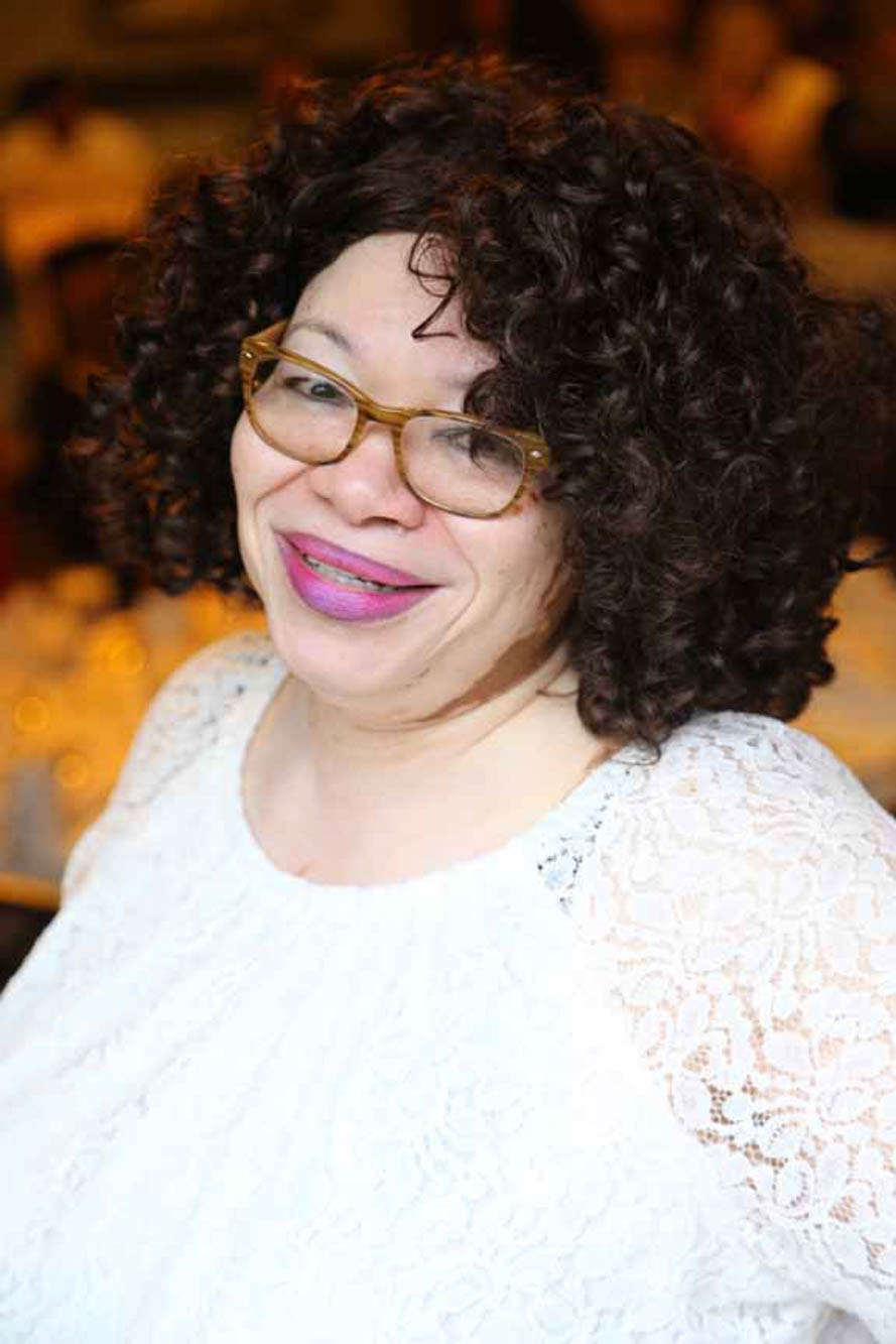 woman with Vitiligo smiling at the camera