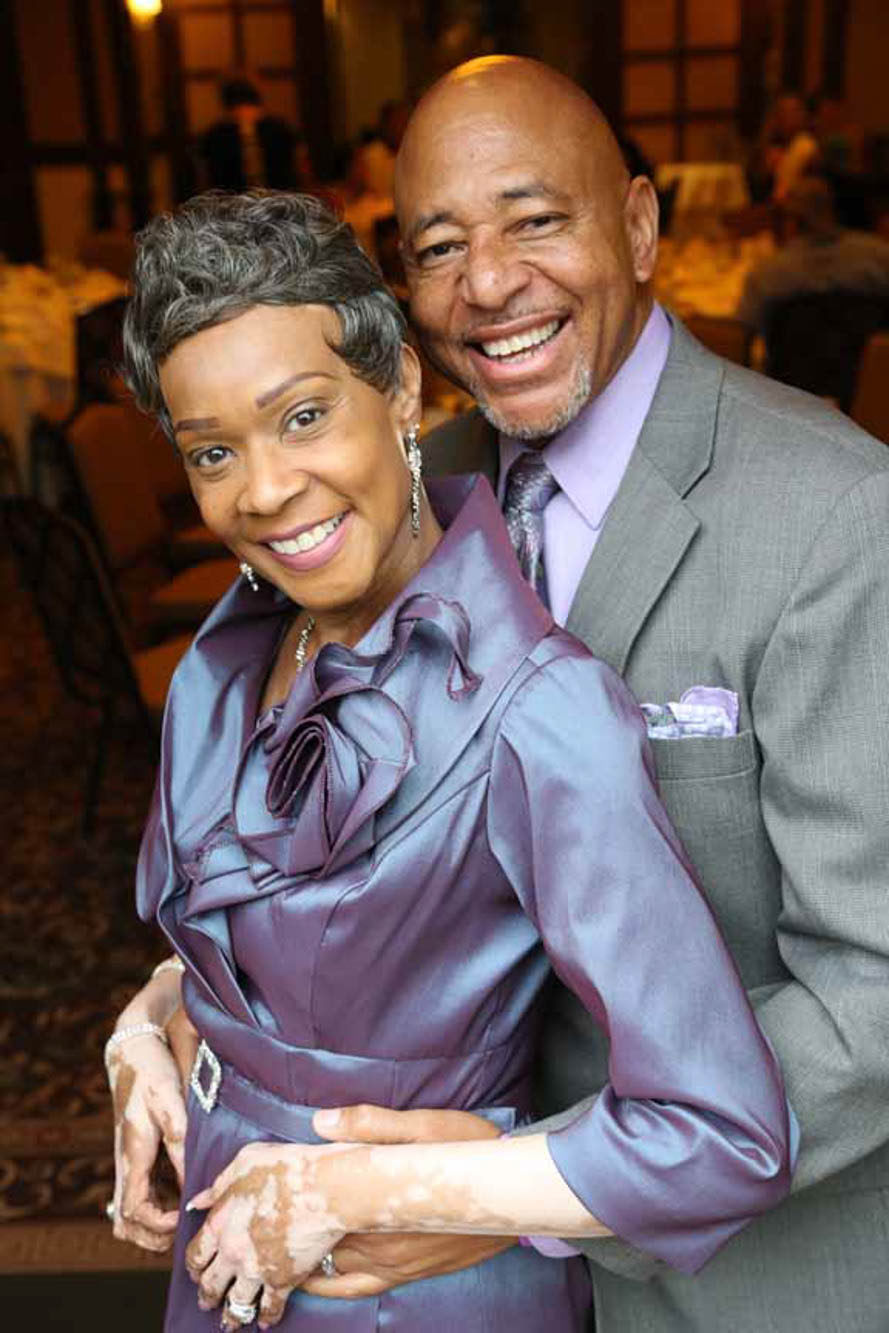 woman with Vitiligo getting hugged by her husband
