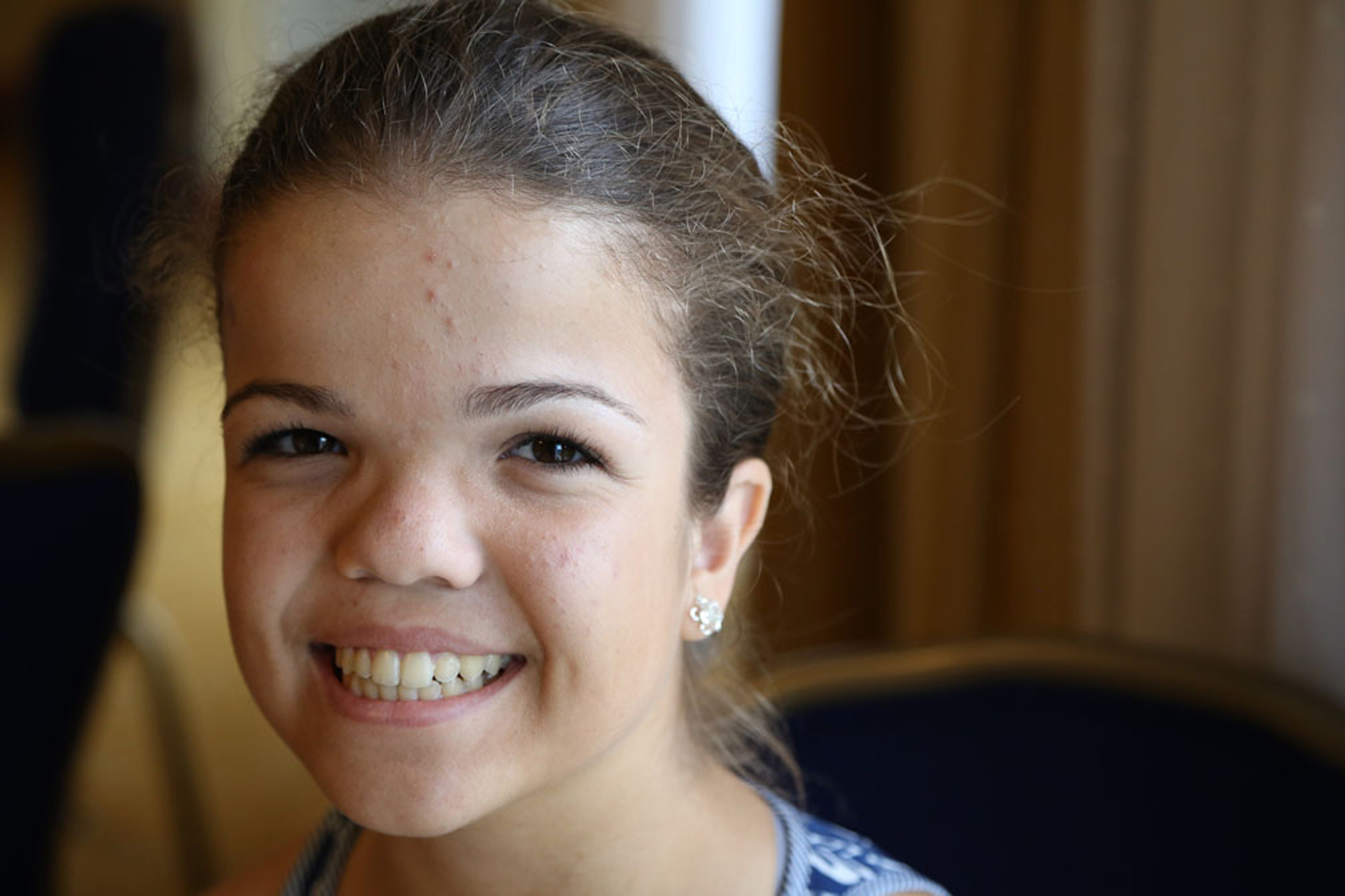girl with skeletal dysplasia smiling closeup photo