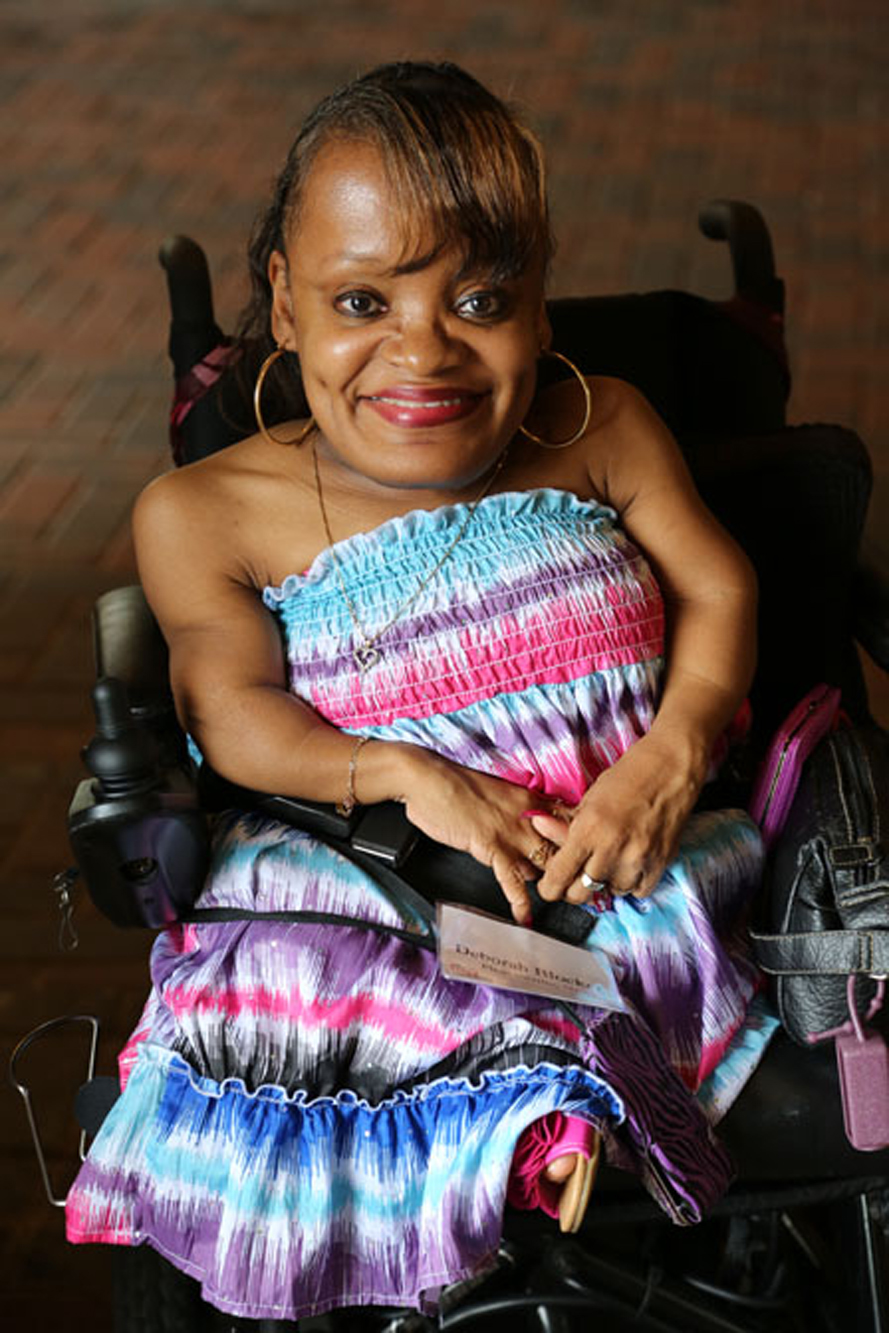 woman with skeletal dysplasia in a wheelchair smiling