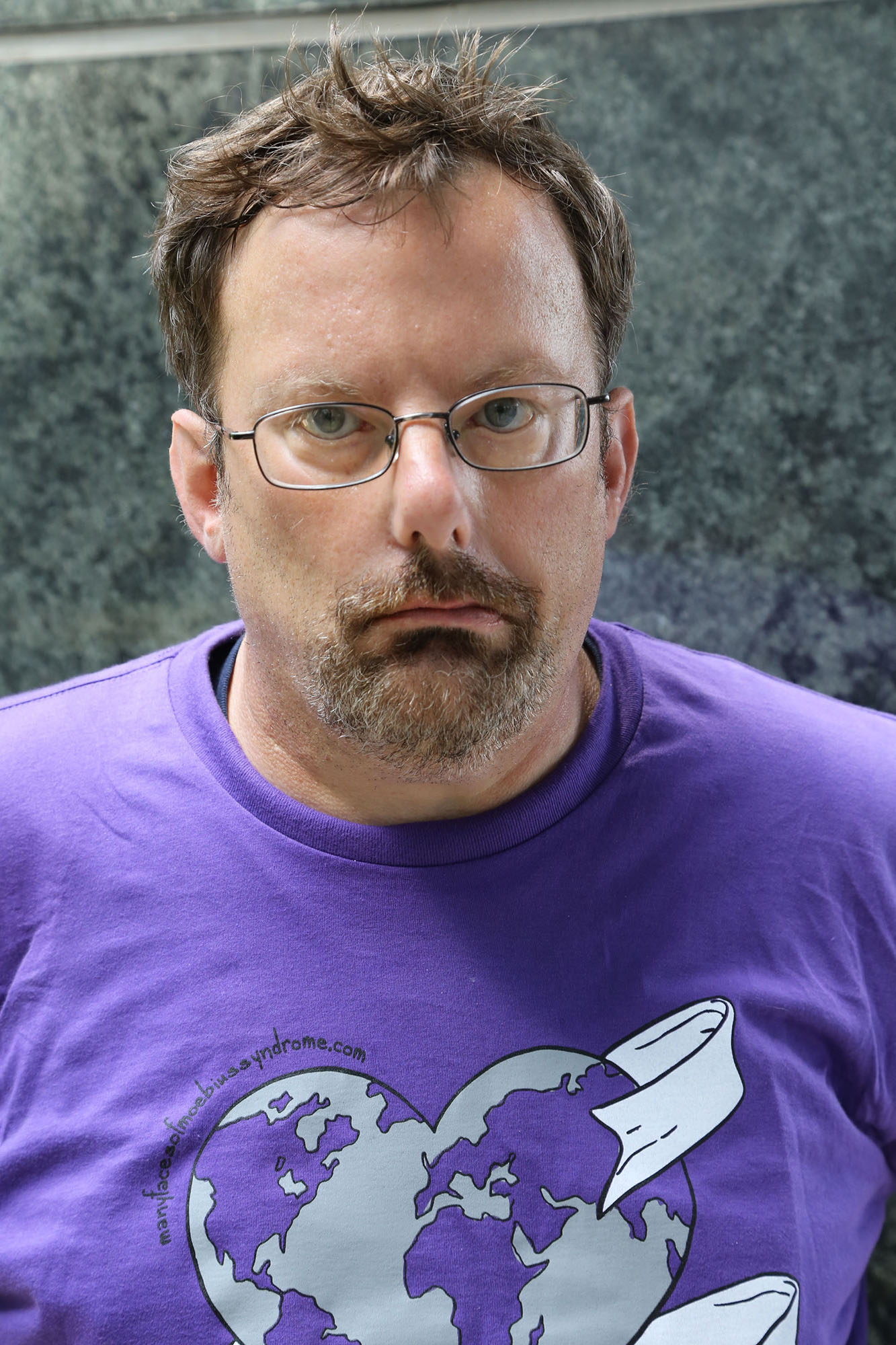 man with moebius syndrome wearing a purple shirt and glasses