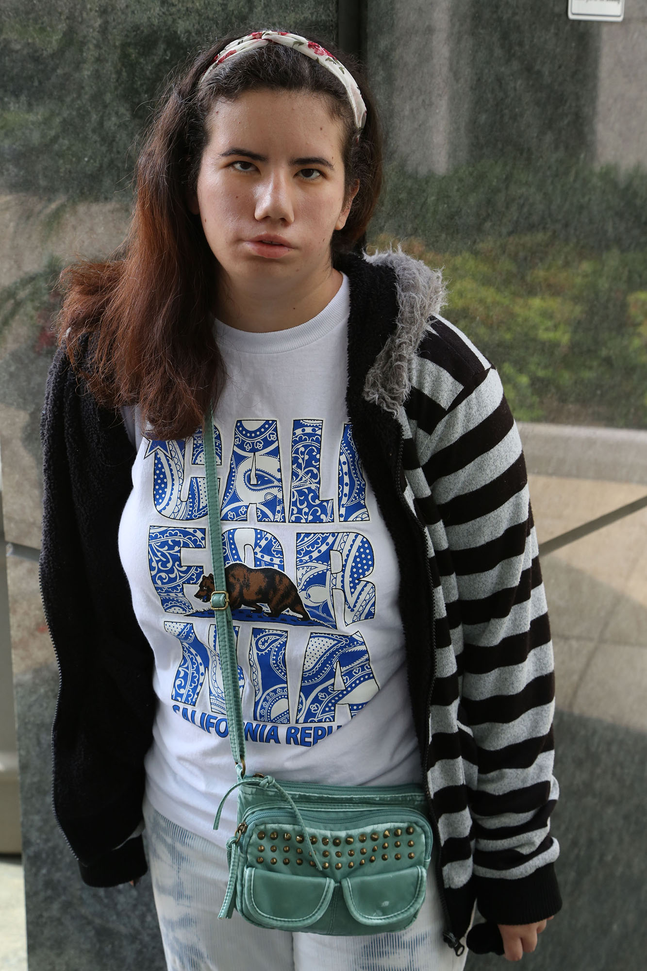 girl with moebius syndrome wearing a black and white striped hoodie