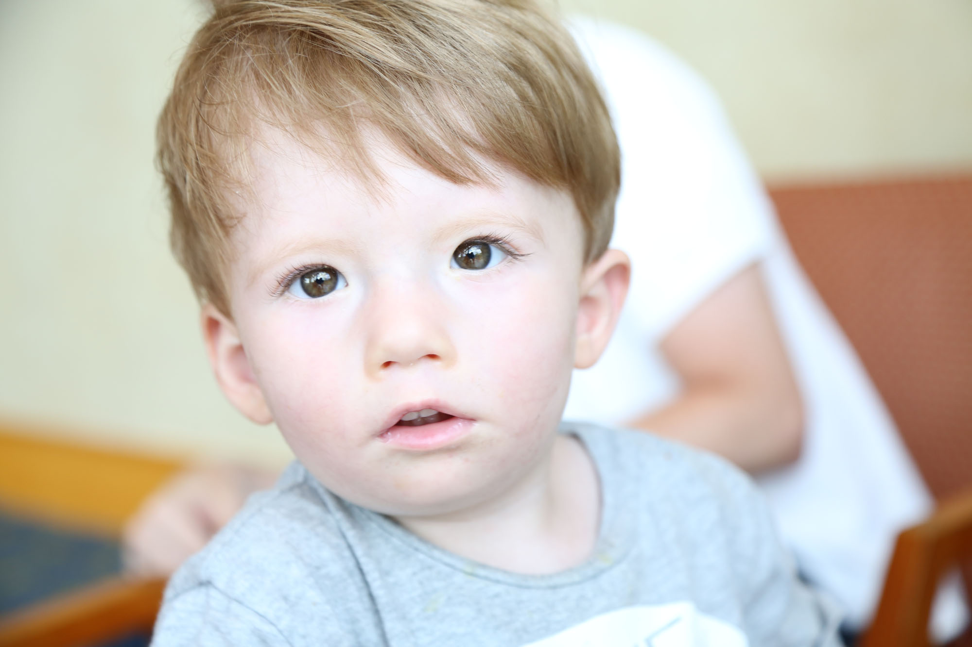 toddler boy with moebius syndrome looks into the camera