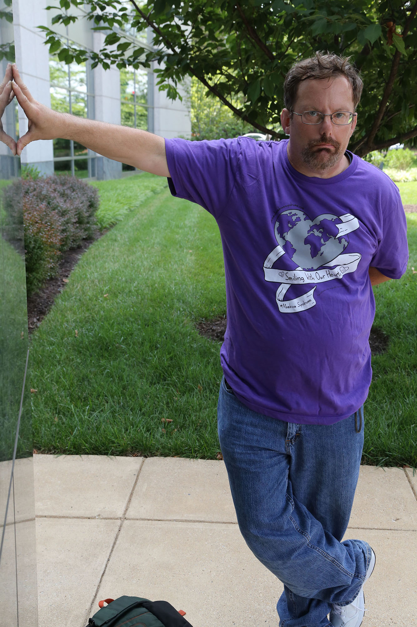 man with moebius syndrome wearing a purple shirt