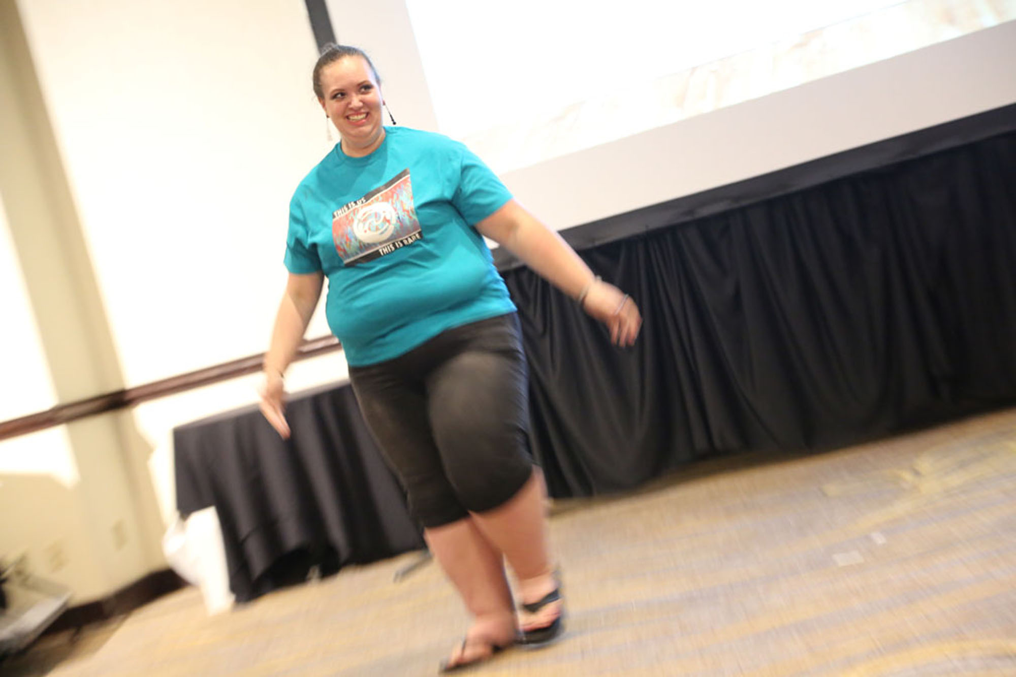 woman with klippel trenaunay syndrome standing up in a conference hall