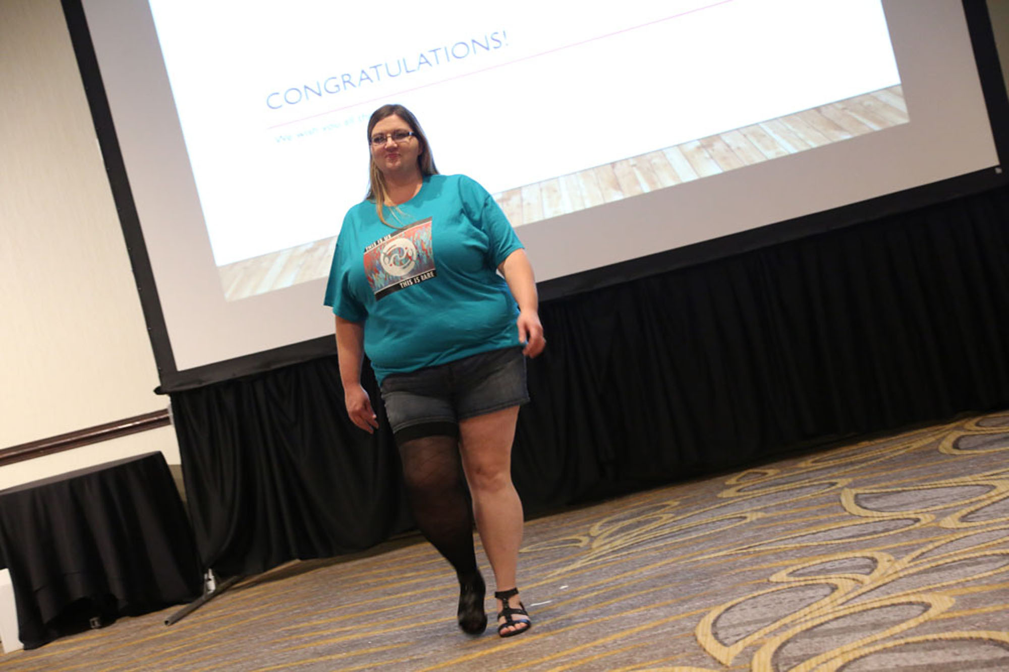 woman with klippel trenaunay syndrome standing up in conference hall