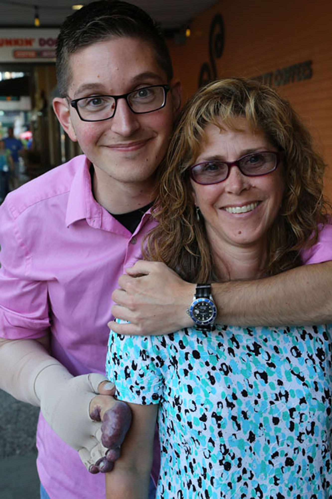 man with Klippel trenaunay syndrome poses with woman, hugging her