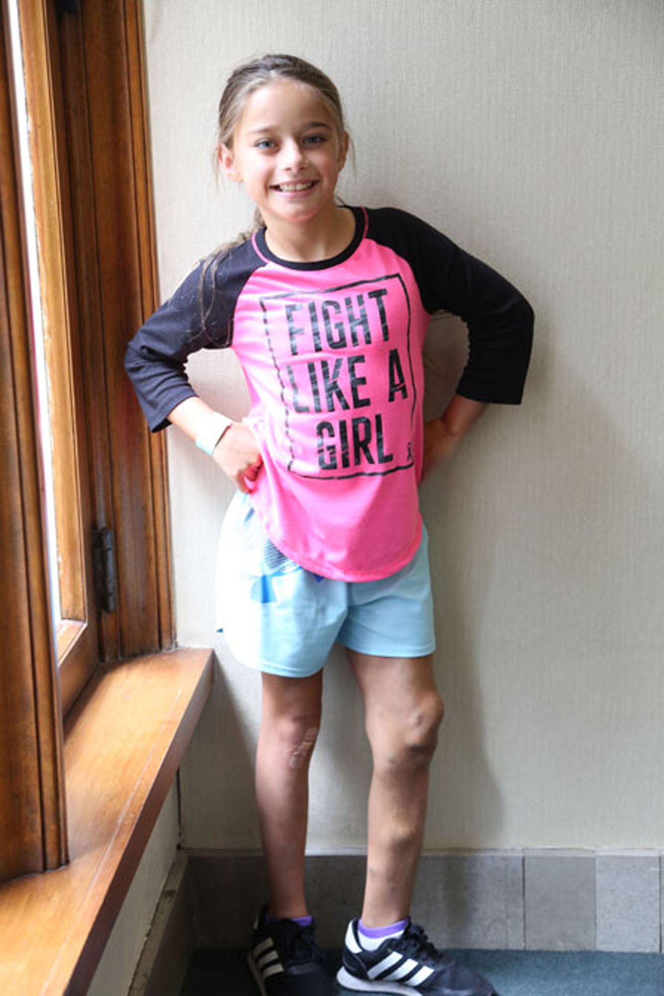young girl with klippel trenaunay syndrome wearing pink shirt and smiling at the camera