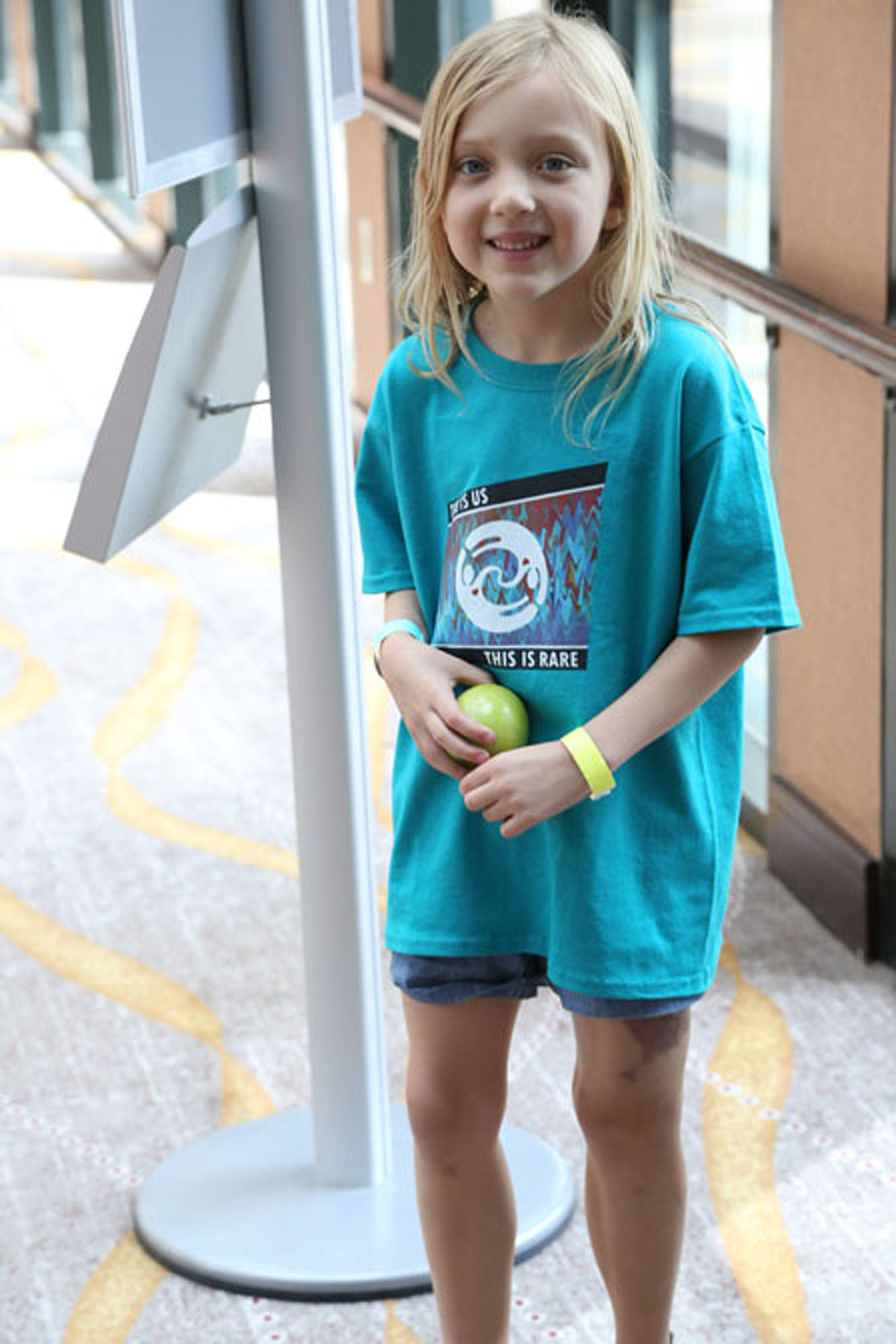 young girl with Klippel trenaunay syndrome smiling at the camera
