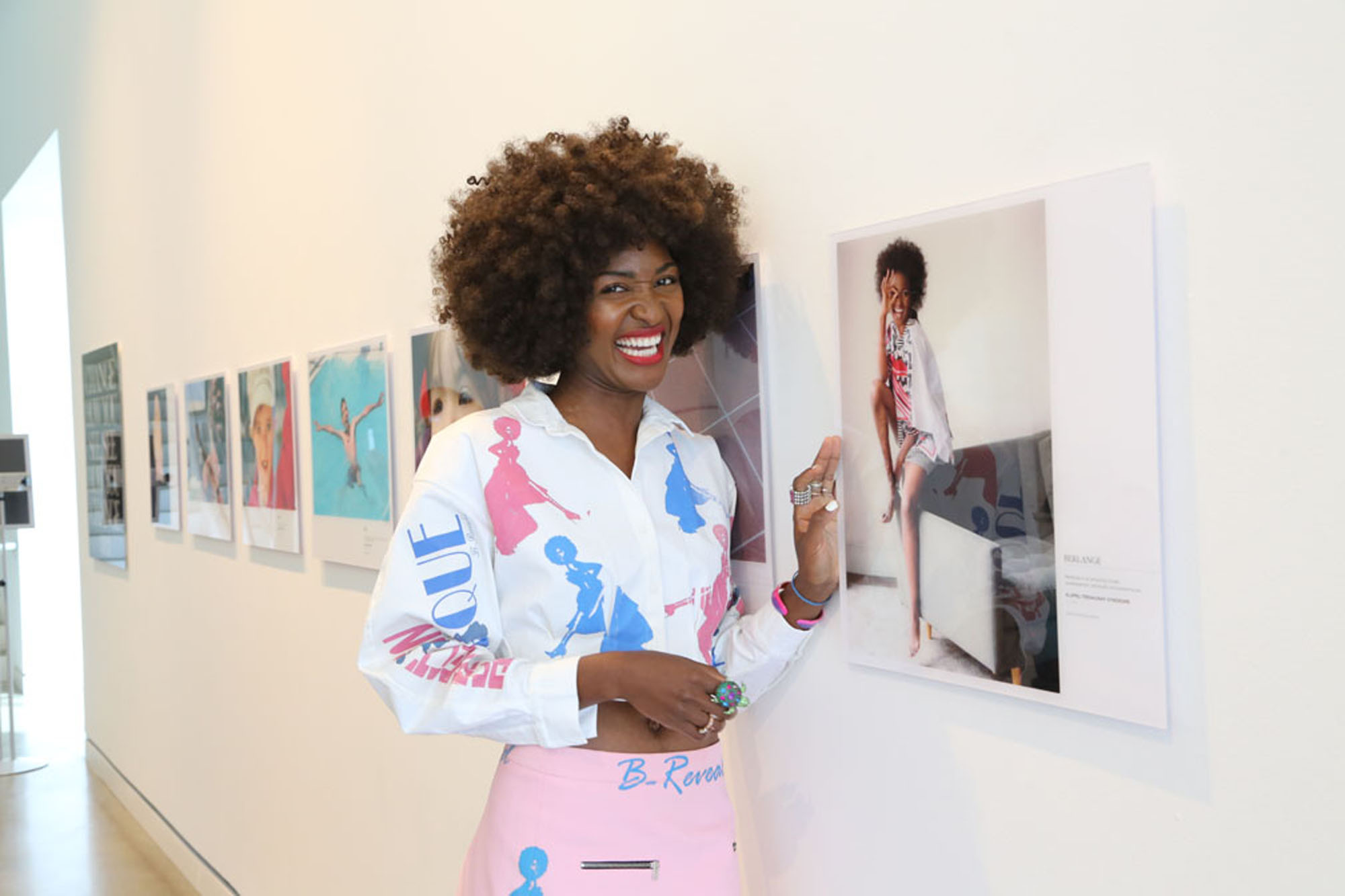 woman with Klippel trenaunay syndrome smiles next to photo of herself at art gallery