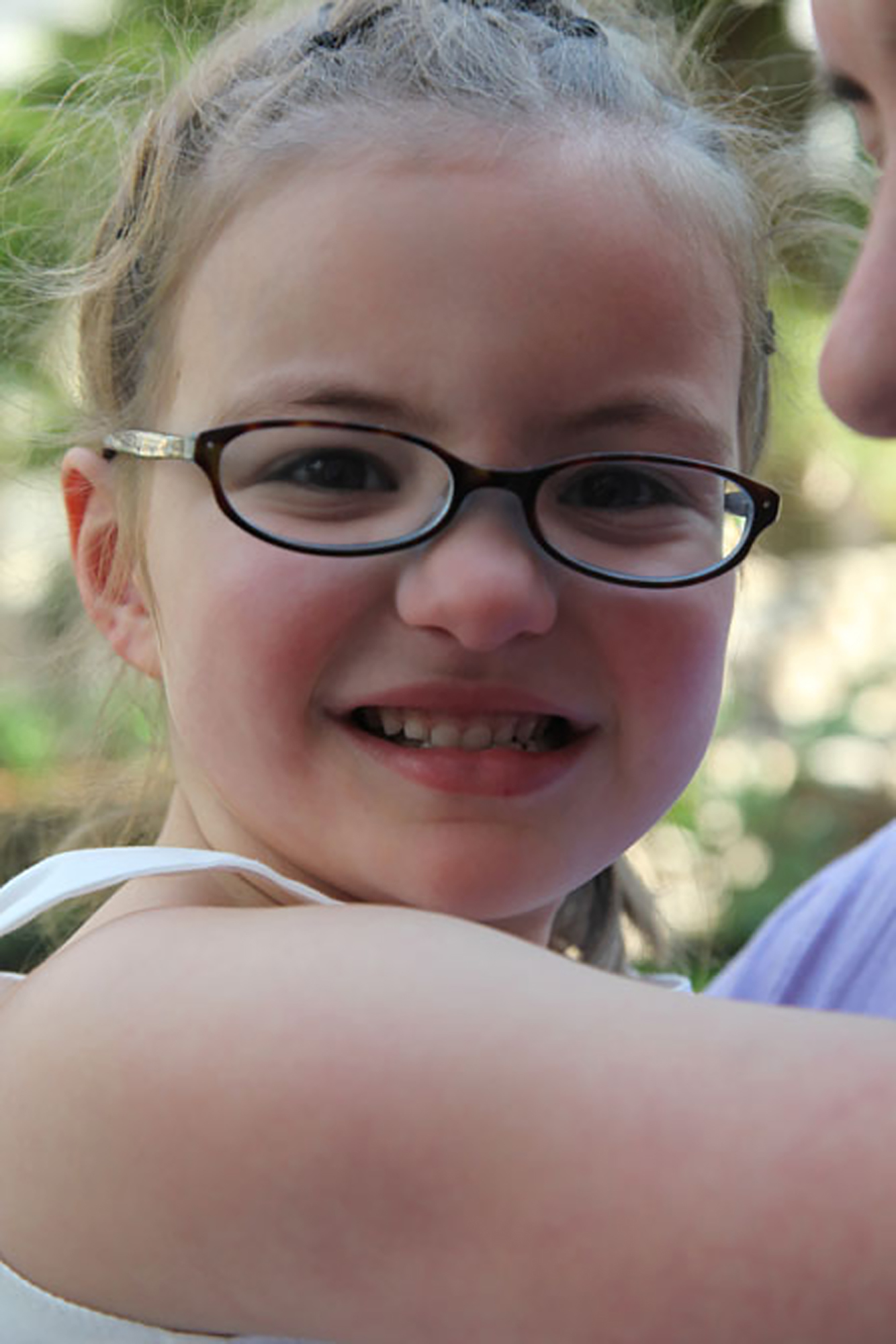 young girl with dravet syndrome wearing glasses