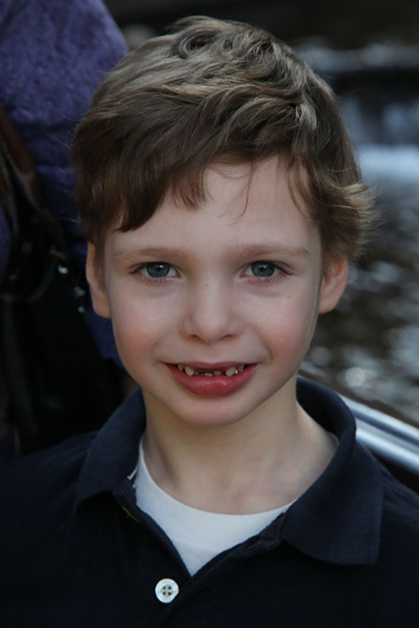 young boy with dravet syndrome looks into the camera