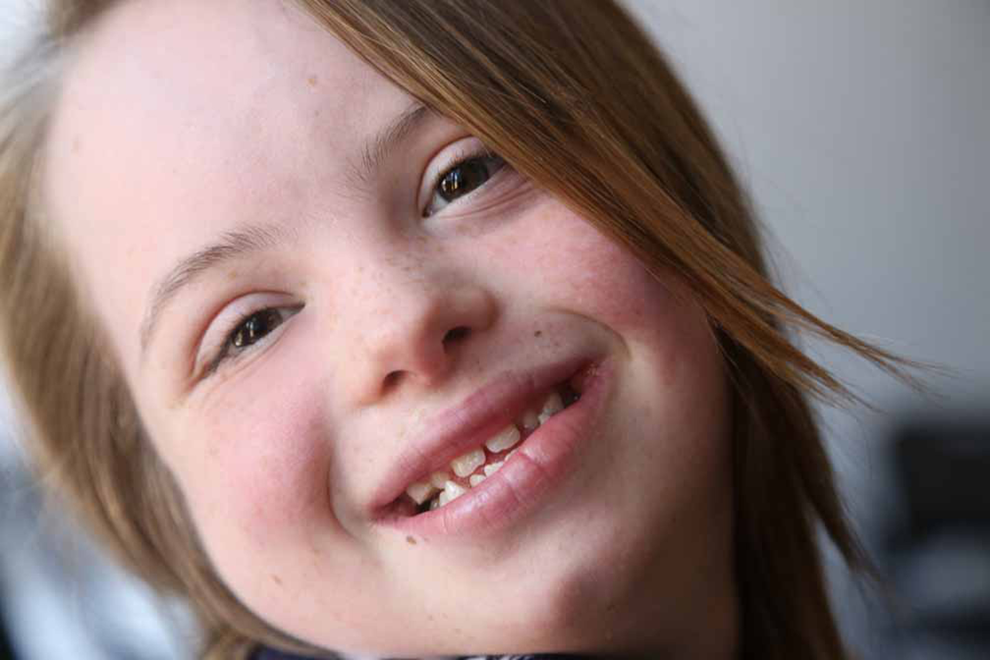 young girl with down syndrome tilting her head sideways smiling