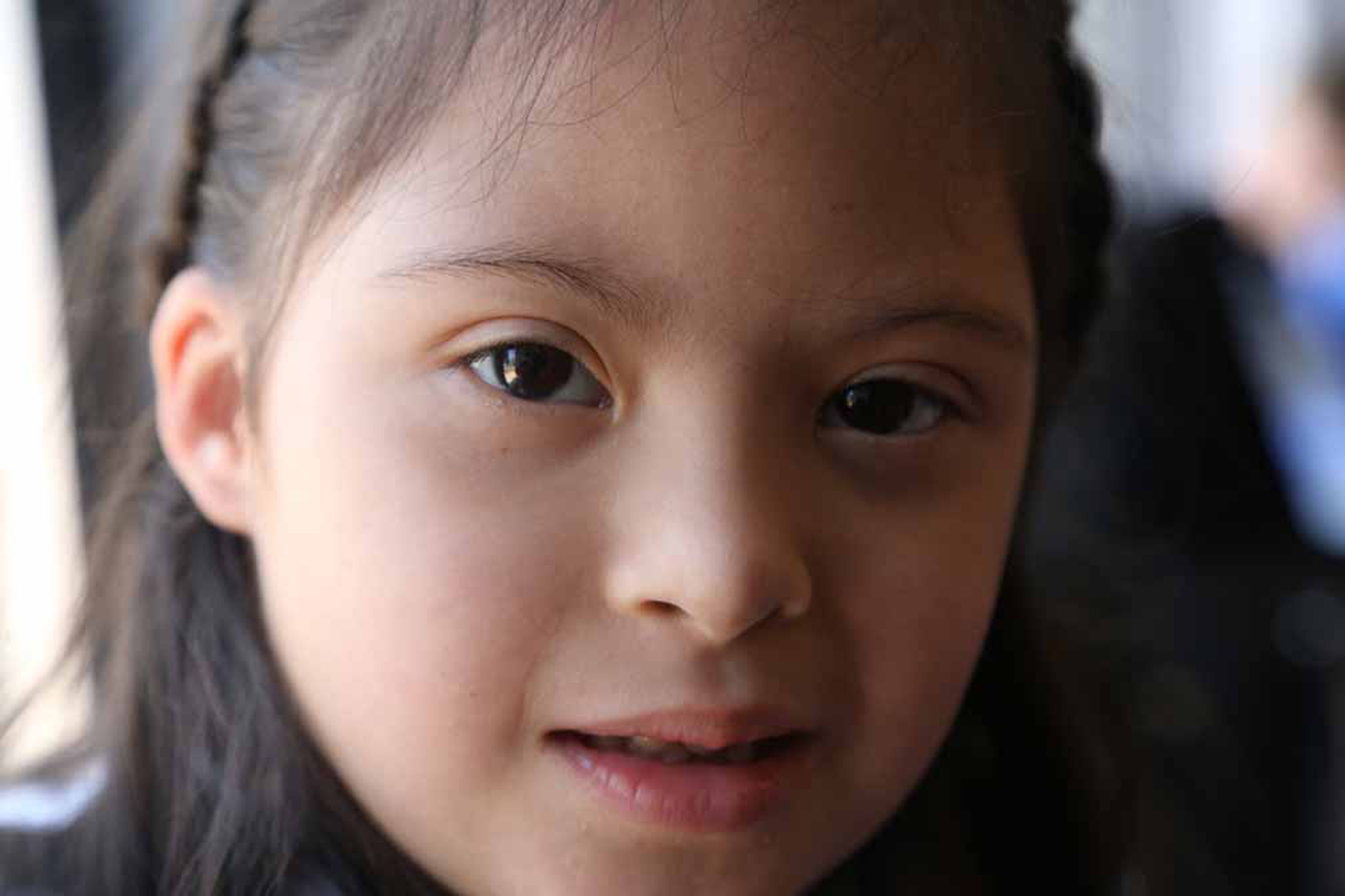 young girl with down syndromes looks deeply into camera