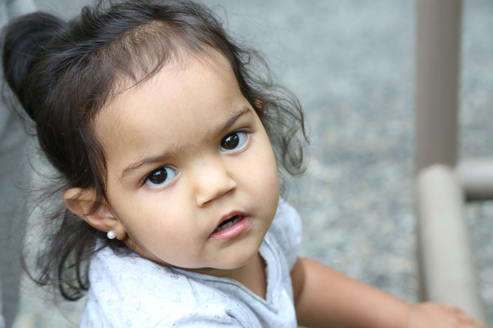 young girl with coffin siris syndrome looking at camera