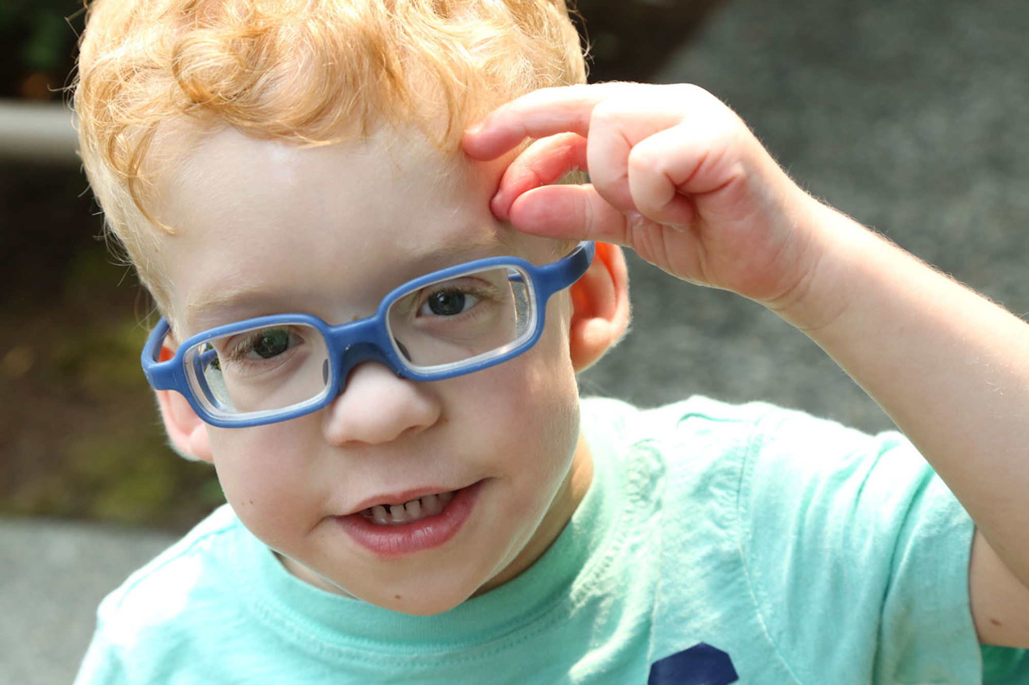 young boy with coffin siris syndrome wearing blue glasses