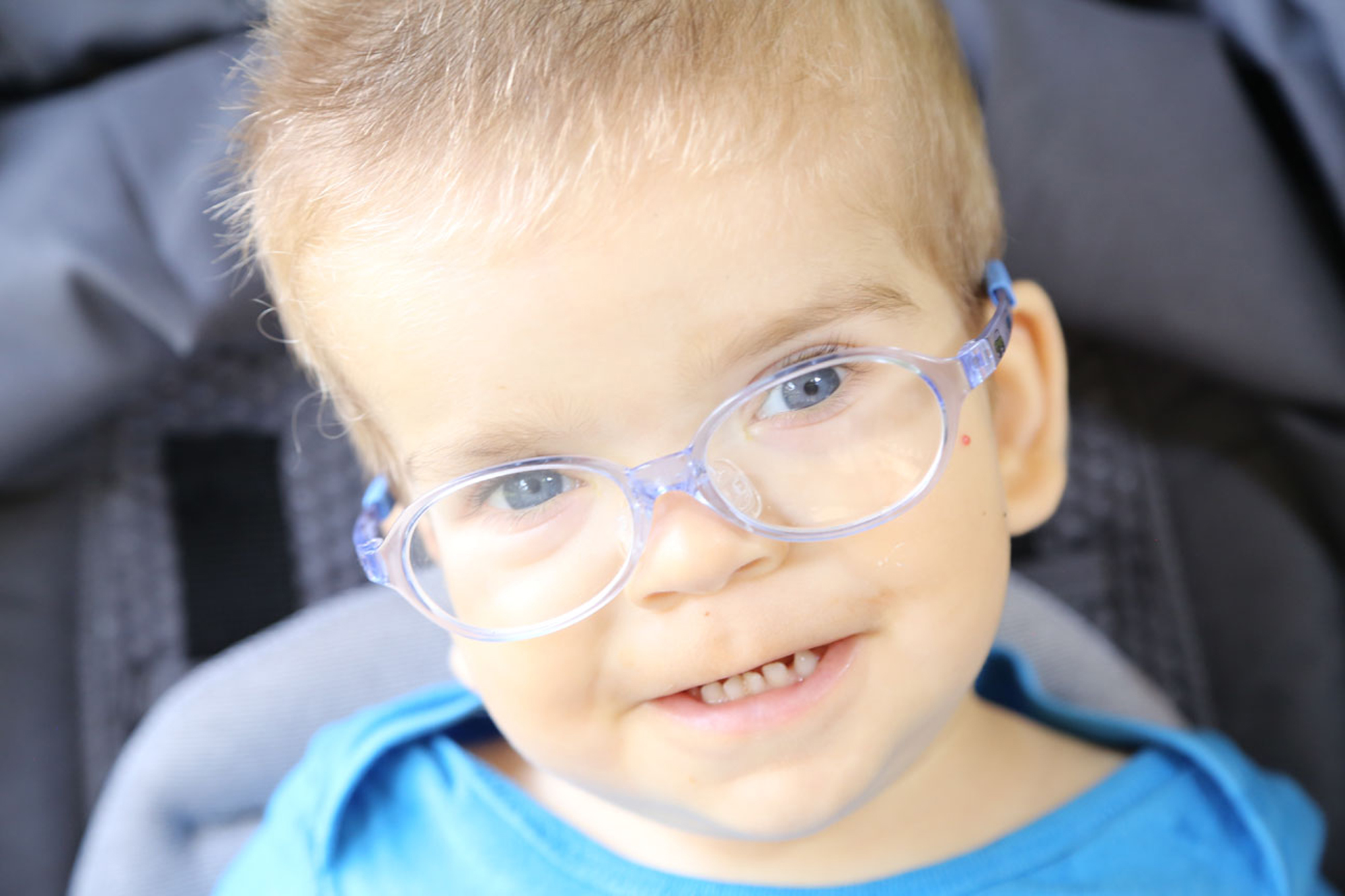 young boy with coffin siris syndrome wearing blue glasses and smiling