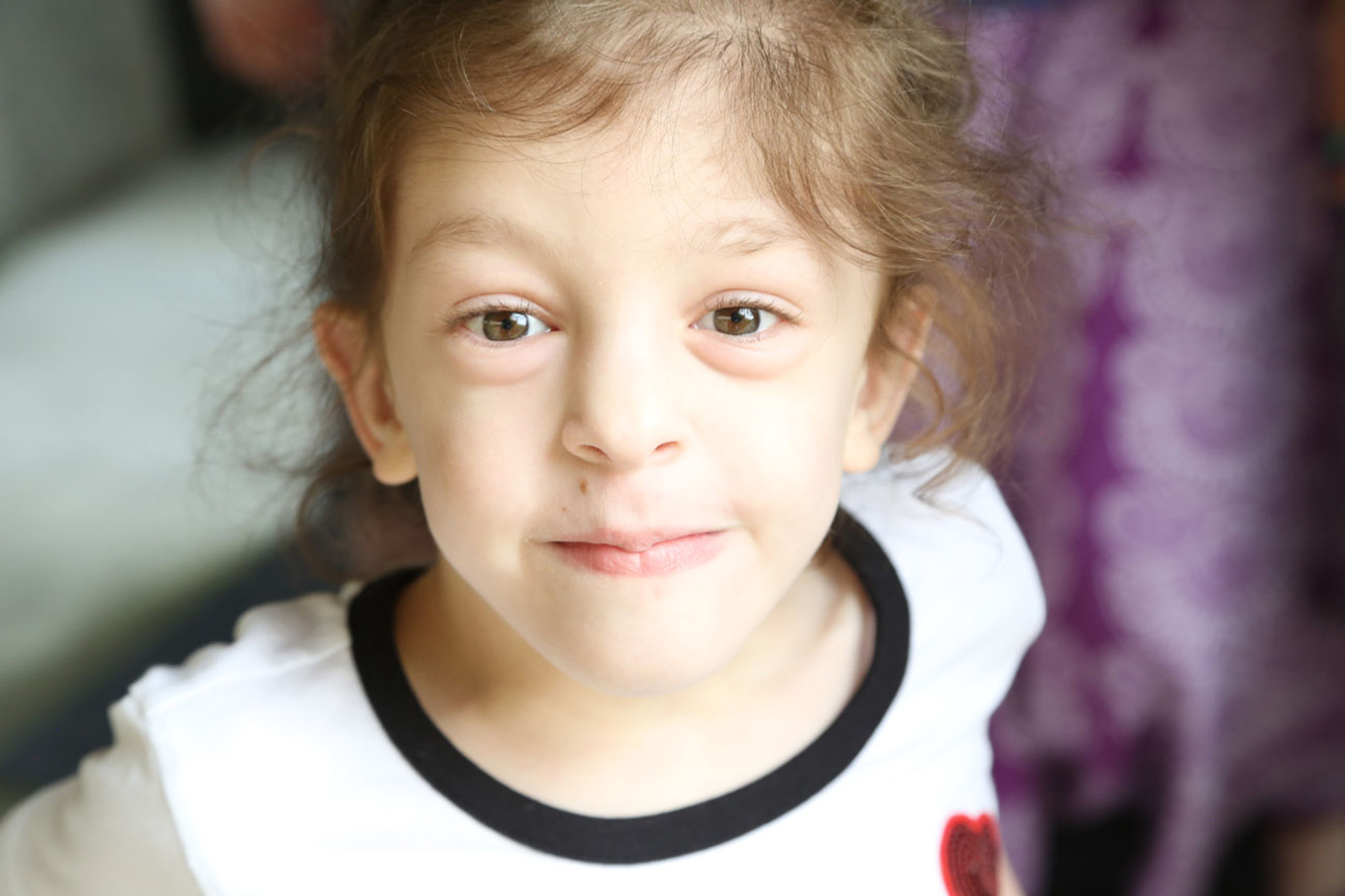 young girl with coffin siris syndrome smiling closeup photo